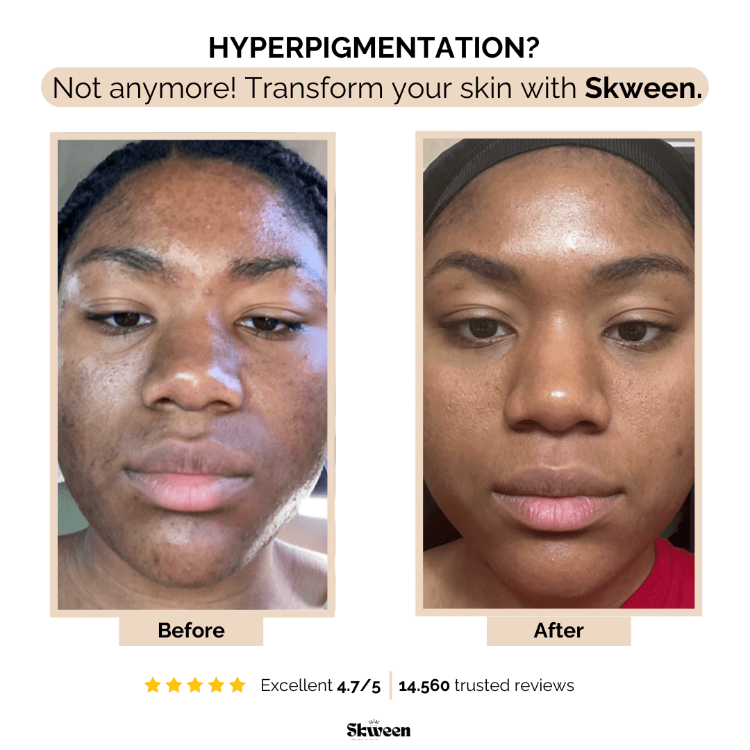Serum Boosted Skin Tint Beauty Balm