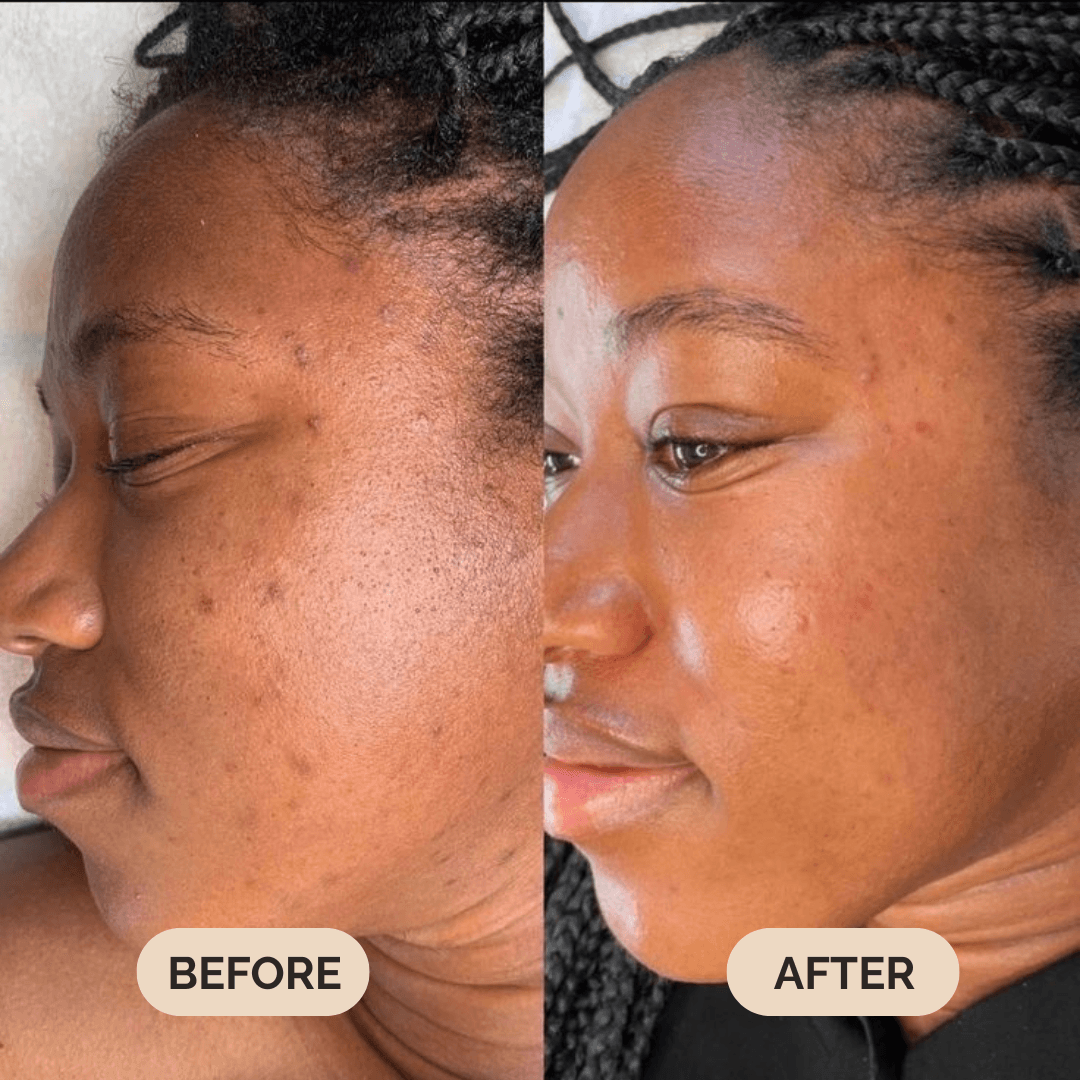 Serum Boosted Skin Tint Beauty Balm