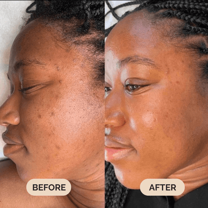 Serum Boosted Skin Tint Beauty Balm