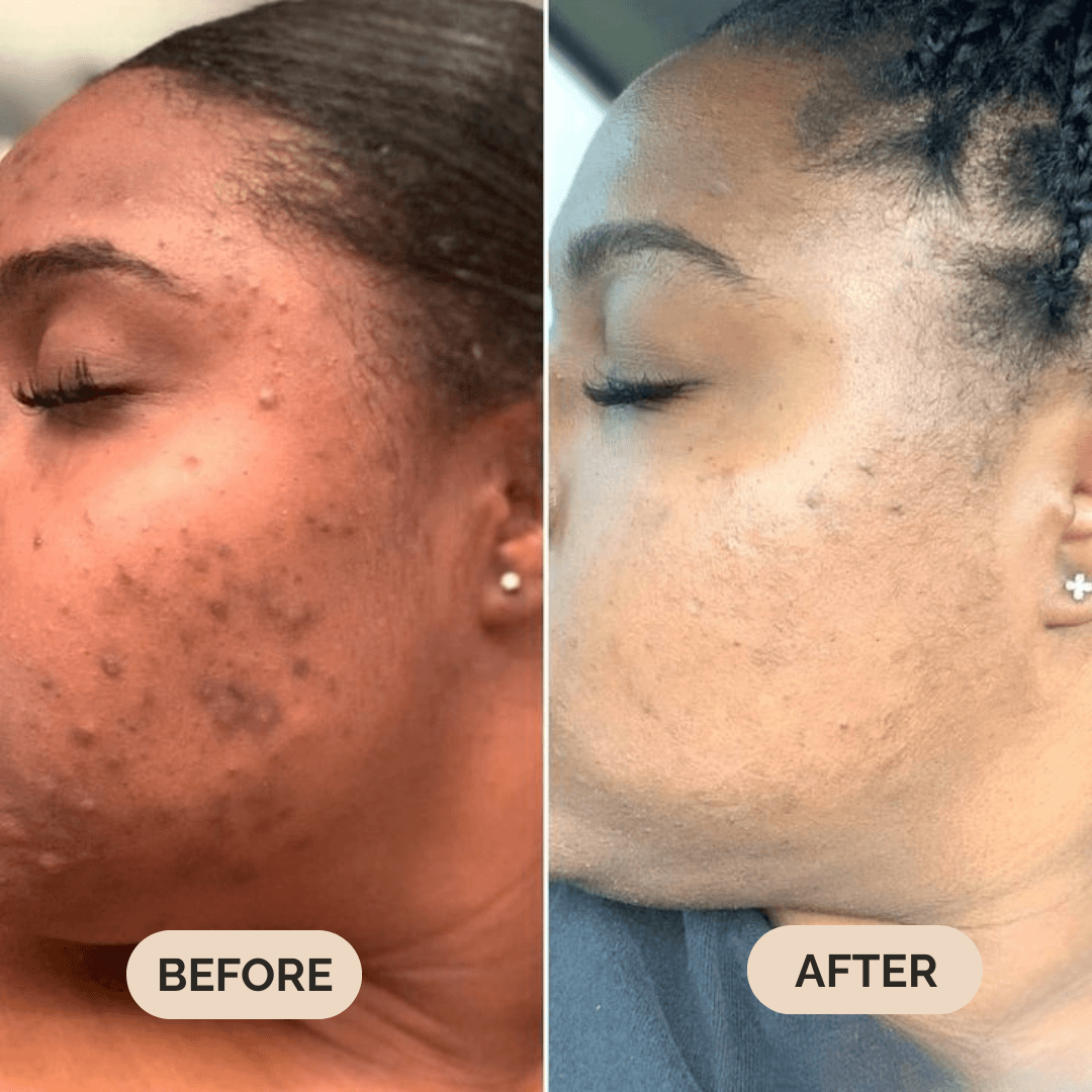 Serum Boosted Skin Tint Beauty Balm