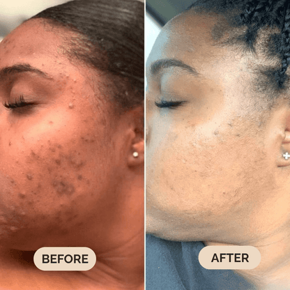 Serum Boosted Skin Tint Beauty Balm